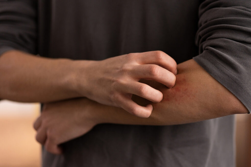 Dust Mite & Allergen Reduction Cleaning